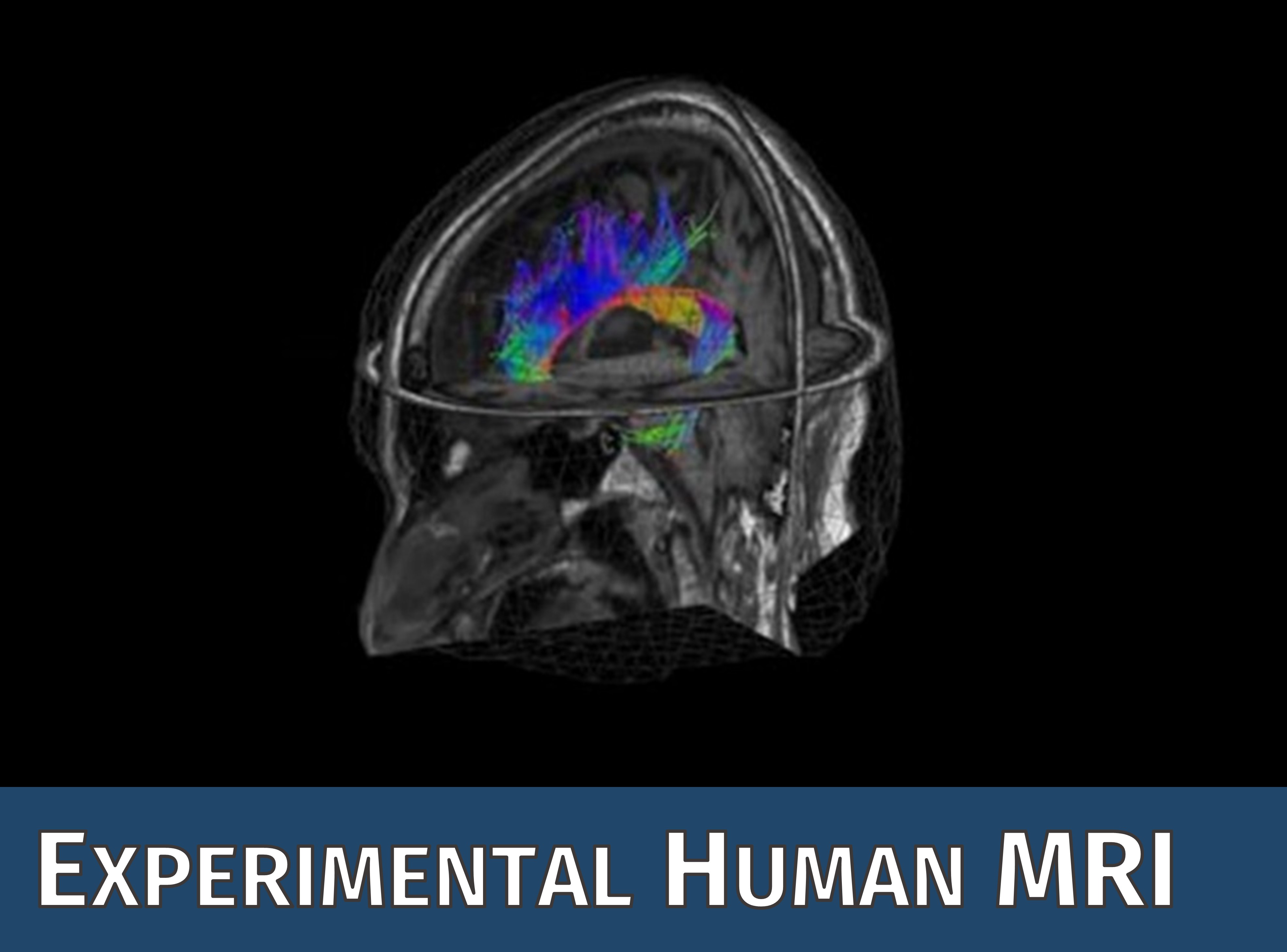 Das Symbolbild der CF Experimental Human MRI zeigt ein beispielhaftes MR Bild vom humanen Kopf mit Diffusionsströmen.