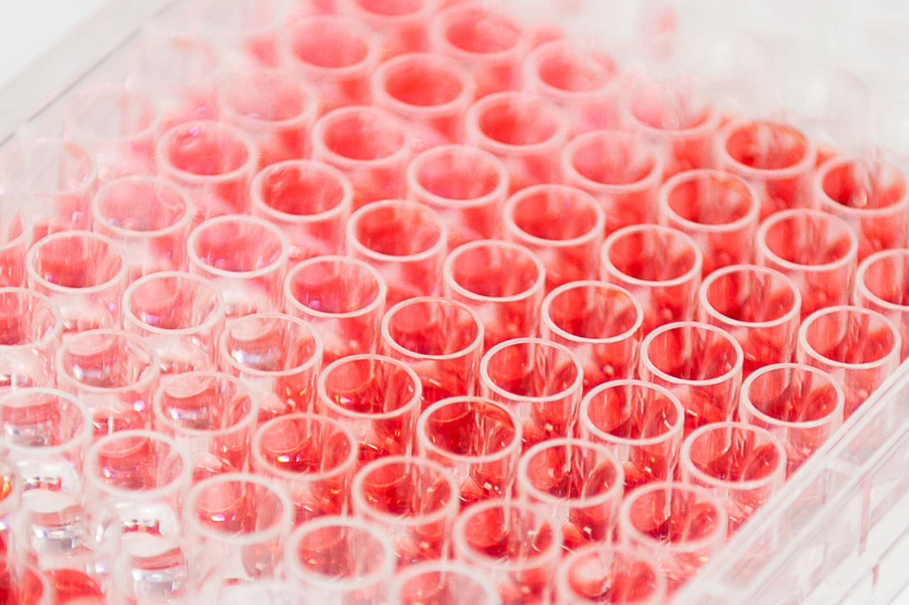 Elisa Proteinanalyse Foto Elisa Proteinanalyse