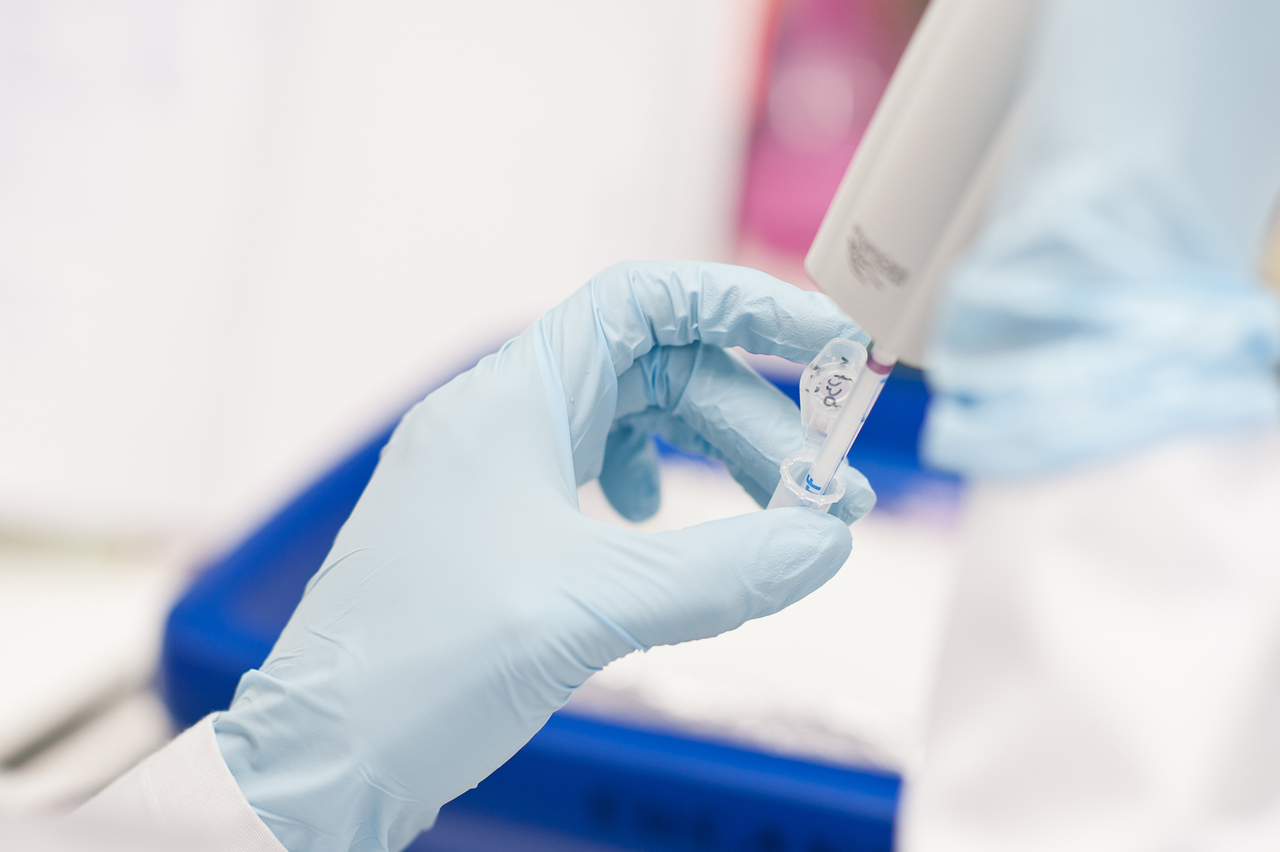 Quantitative Bestimmung von mRNA Expression Foto Quantitative Bestimmung von mRNA Expression