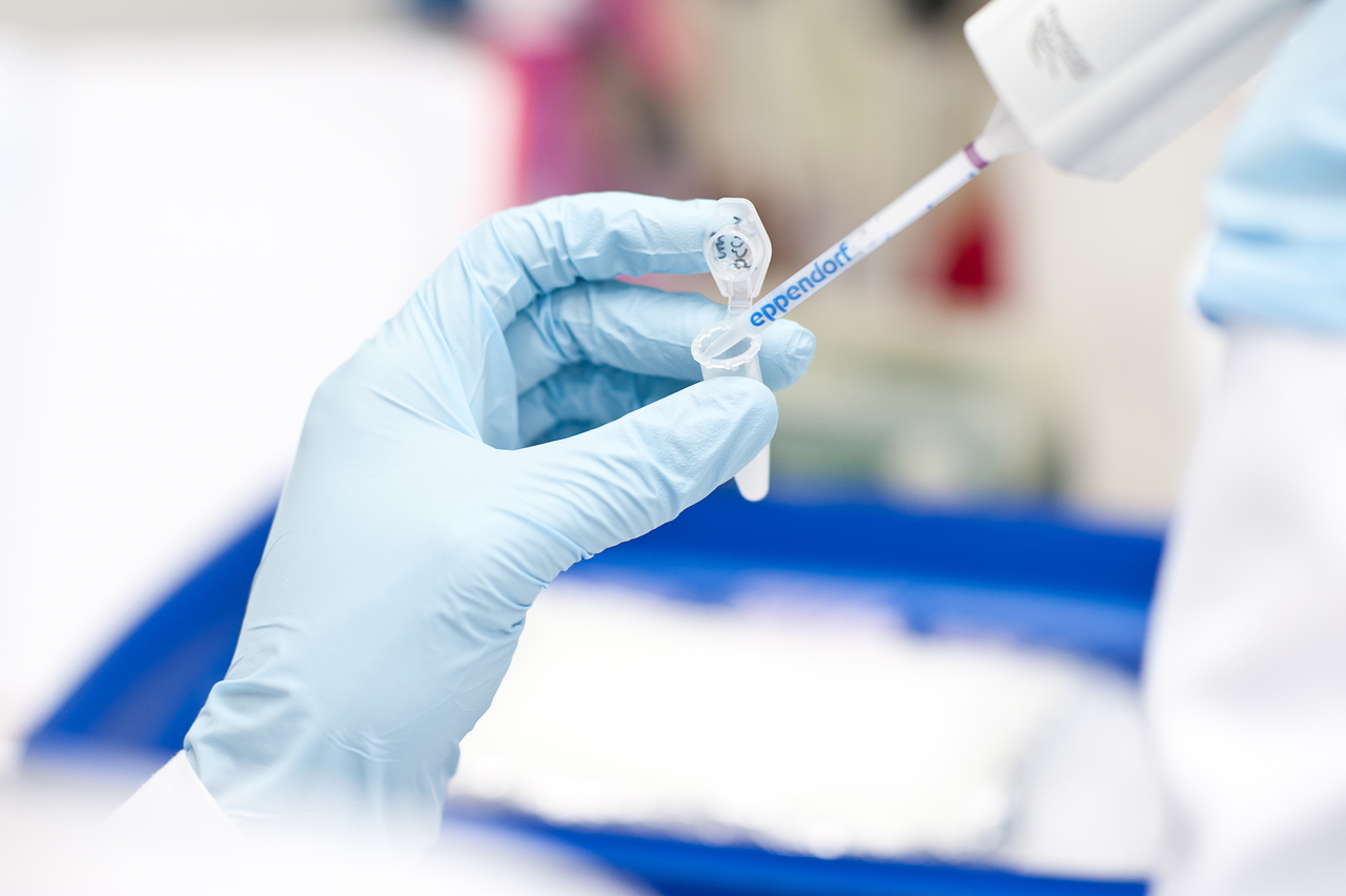Quantitative Bestimmung von mRNA Expression Foto Quantitative Bestimmung von mRNA Expression