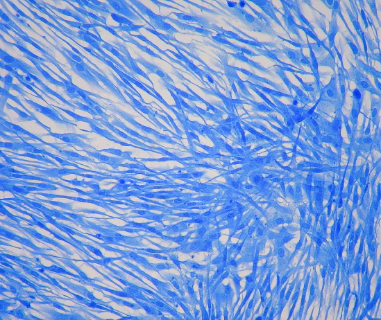 Miskroskopaufnahme seneszenter Fibrolasten