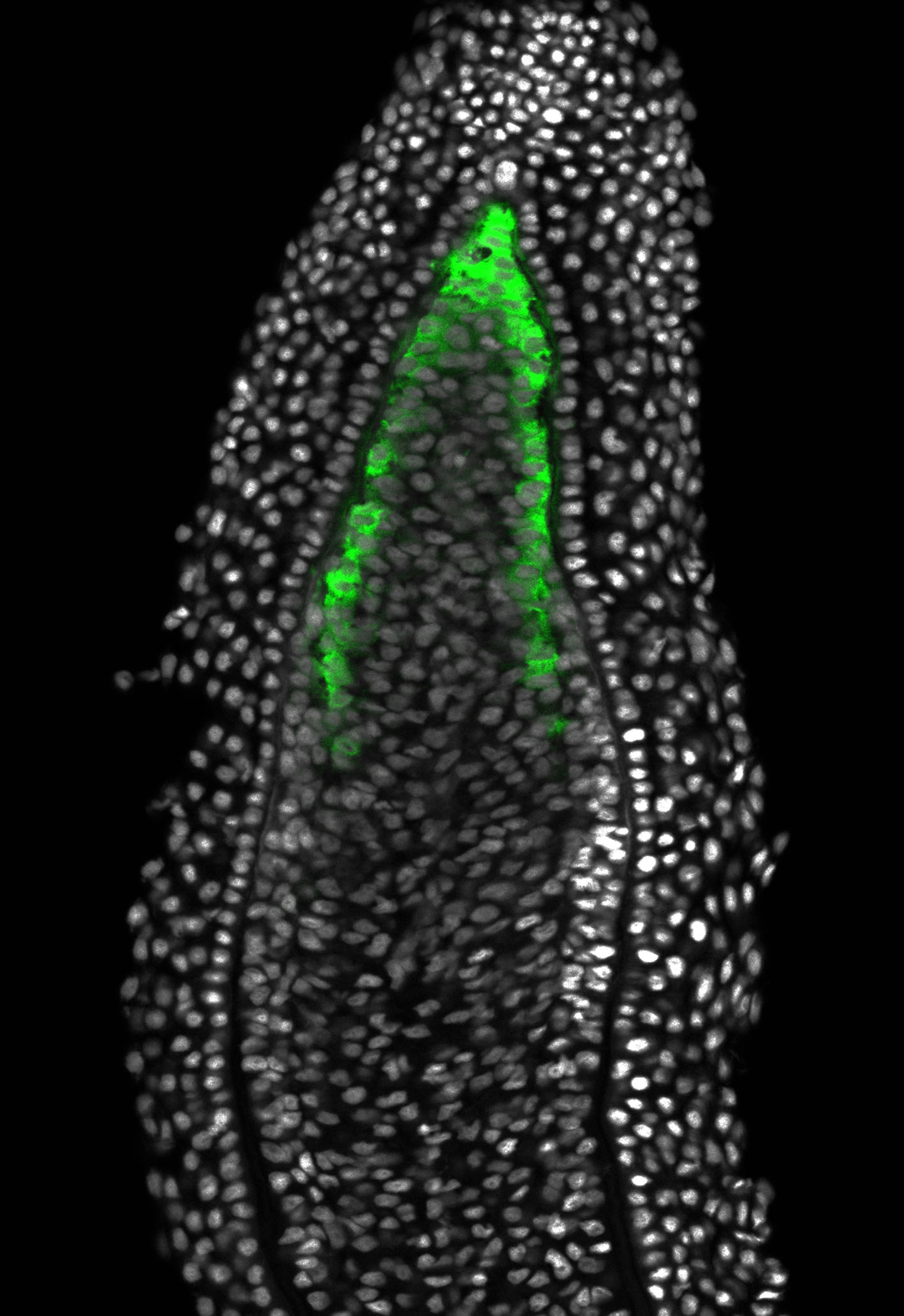 Fluoreszenzmikroskopische Aufnahme eines Blastems, grün leuchtend erkennt man aktivierte Wnt-Signale.