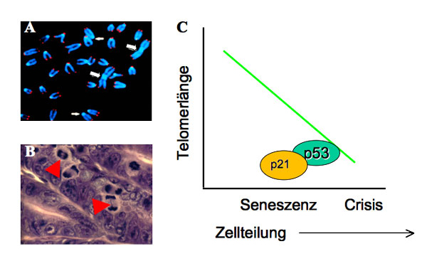 Abb.1: Telomerverkürzung führt zur Induktion von chromosomaler Instabilität und begrenzt die Teilungsfähigkeit menschlicher Zellen. (A) Die Abbildung zeigt Metaphasechromosomen. Die Telomere sind mit einer rotfluoreszierenden Probe markiert. Man erken