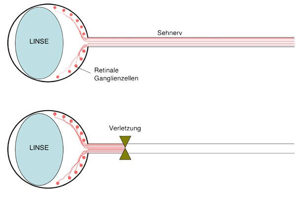 Abb.1: Schematische Darstellung des Auges mit Sehnerven Abb.1: Schematische Darstellung des Auges mit Sehnerven. Retinale Ganglienzellen (RGZ) sind die Projektionsneurone des visuellen Systems, welche die Reize von der Netzhaut ins Gehirn weiterleiten. Der Zellkörper dieser Neurone befindet sich in der Retina