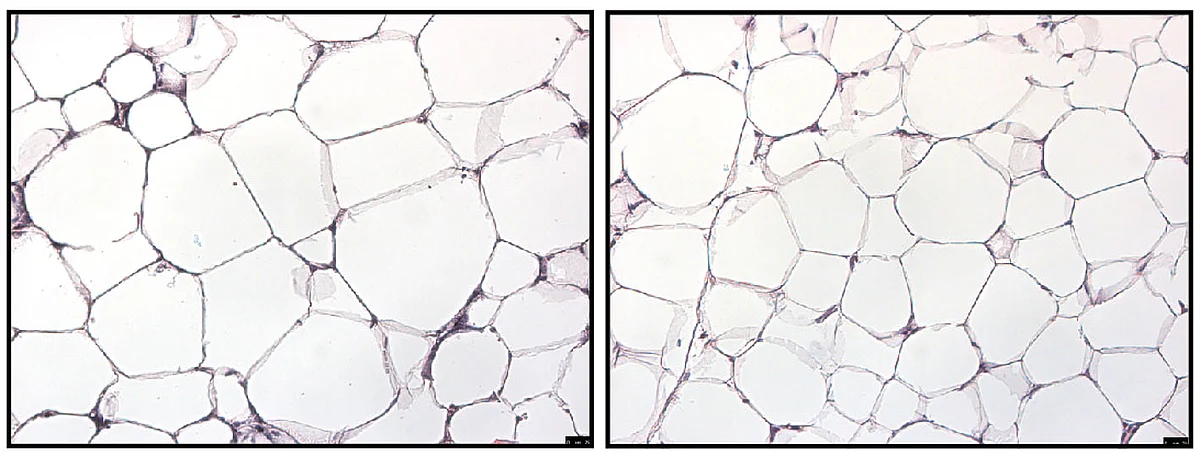 The fat cells of the wild-type mice in the control group (left) are considerably bigger after a high-fat diet than those of the mice with deactivated GR receptors (right), in which the cortisol-induced stress signal is blocked. 