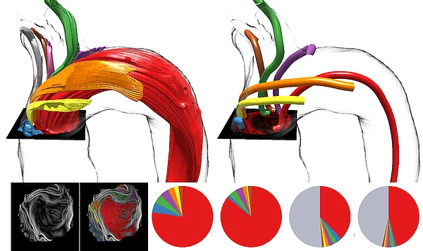 Visualisierung von Blutströmen (Englund et al)