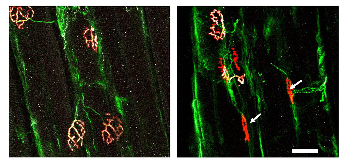 fluoreszenzmikroskopische Aufnahmen Synapsen und Axone 