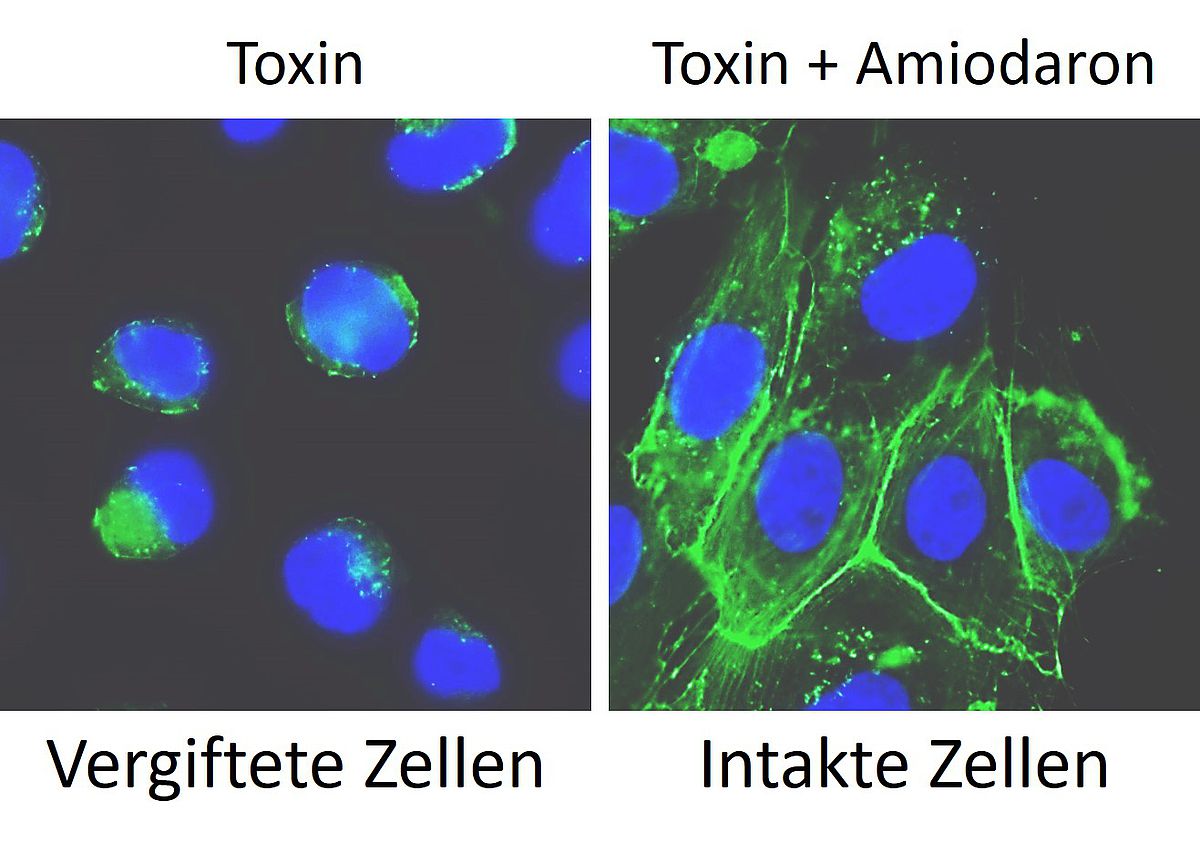 Bakterien-Toxine vergiften Zellen 