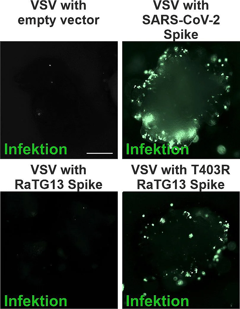 Die fluoreszenzmikroskopischen Aufnahmen Infektion von Darm-Organoiden
