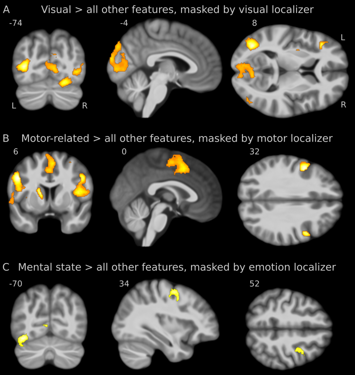 Brain activation patterns 