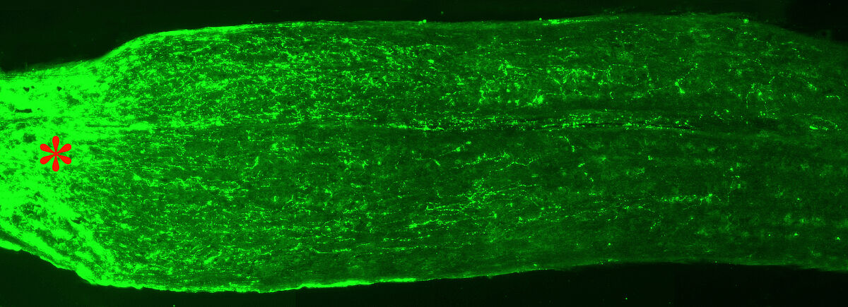 Regenerierende Axone von Retinalen Ganglienzellen (grün), die in den den verletzten Sehnerven einwachsen. Die Verletzungsstelle des Nervs ist mit einem roten Stern gekennzeichnet.