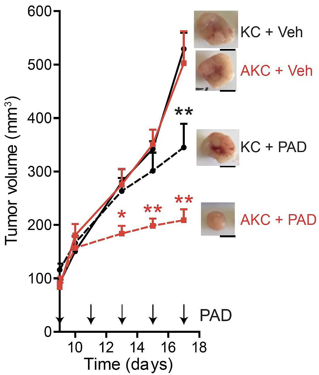 In the mouse model, the tumours with additional ATM loss (AKC) react significantly better to the therapy combination with PARP-, ATR- and DNA-PK inhibitors (PAD) than the generally used controls with simple KRAS mutation (KC)