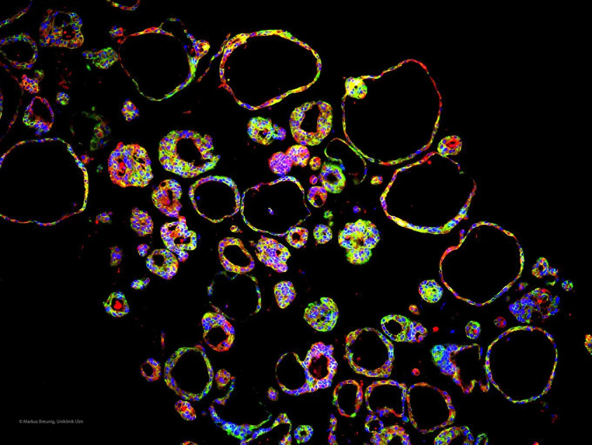 Organoid aus Pankreaszellen