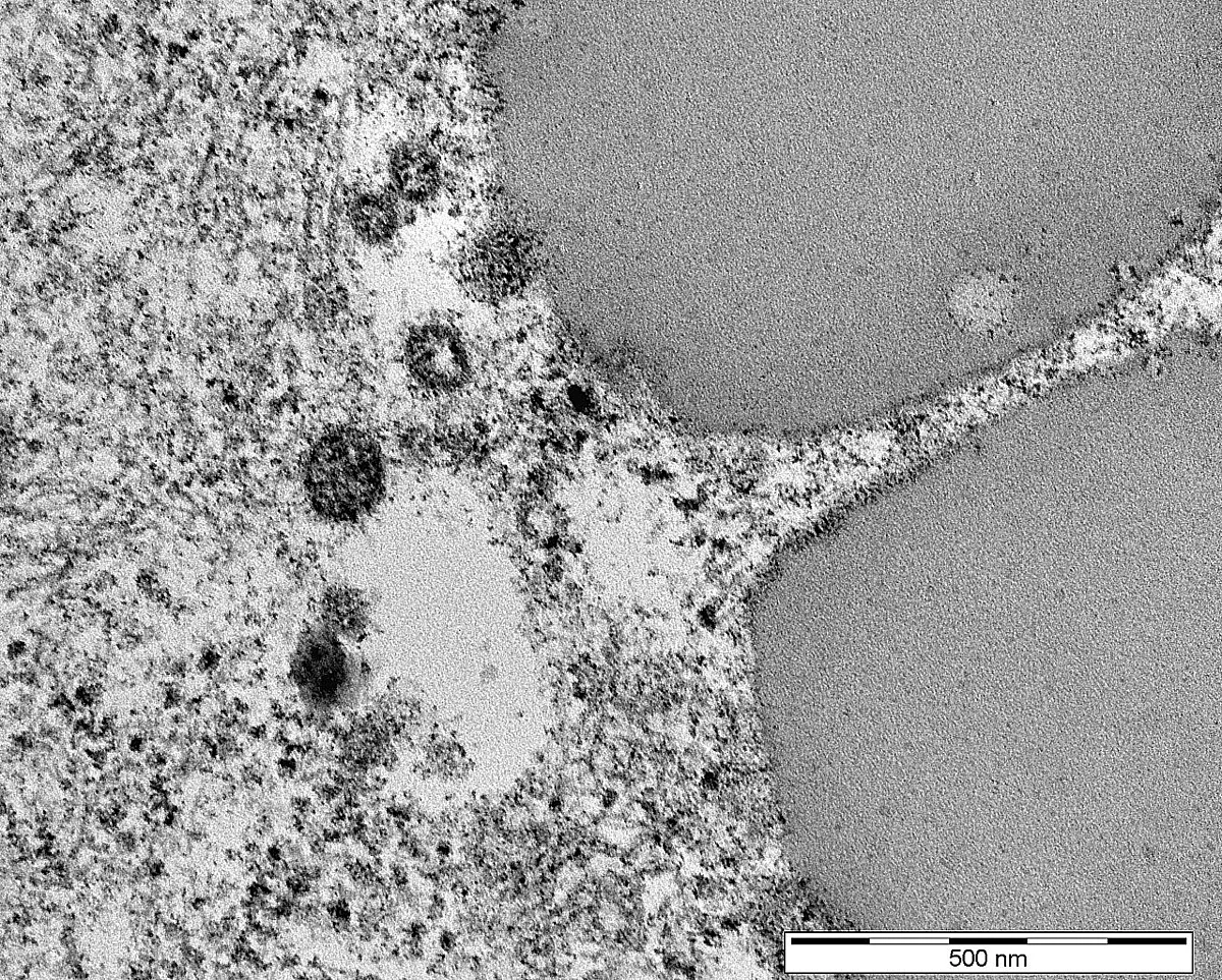 Elektronenmikroskopische Aufnahme von Coronaviren im Gewebe der Bauchspeicheldrüse 