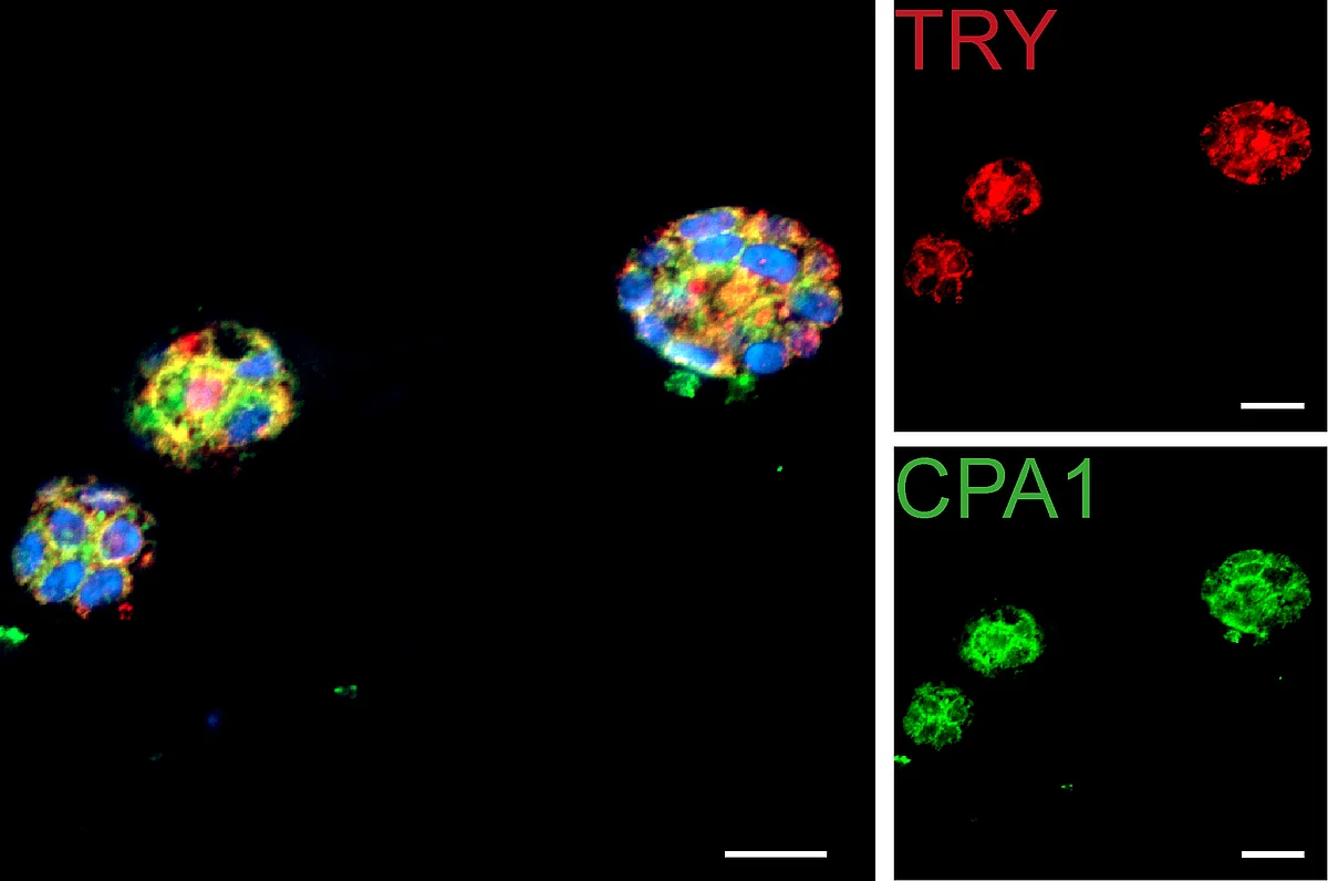 Immunfluoreszenzfärbung von azinären Organoiden