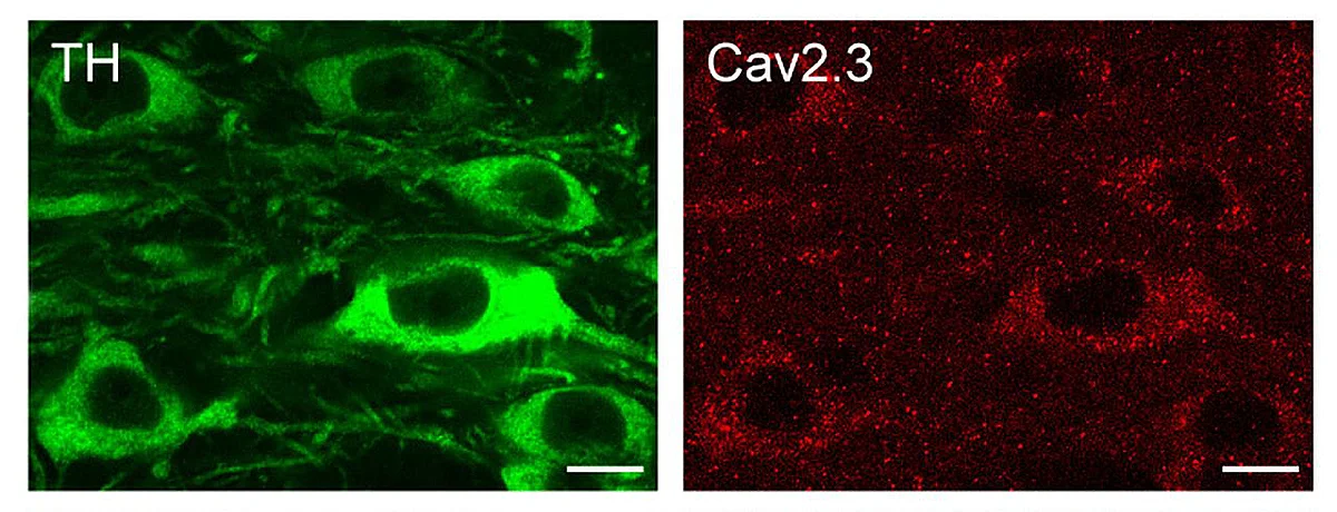 dopamine-producing nerve cells