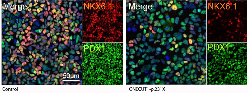 Immunfluoreszenz Färbung zum Nachweis von Pankreasvorläuferzellen