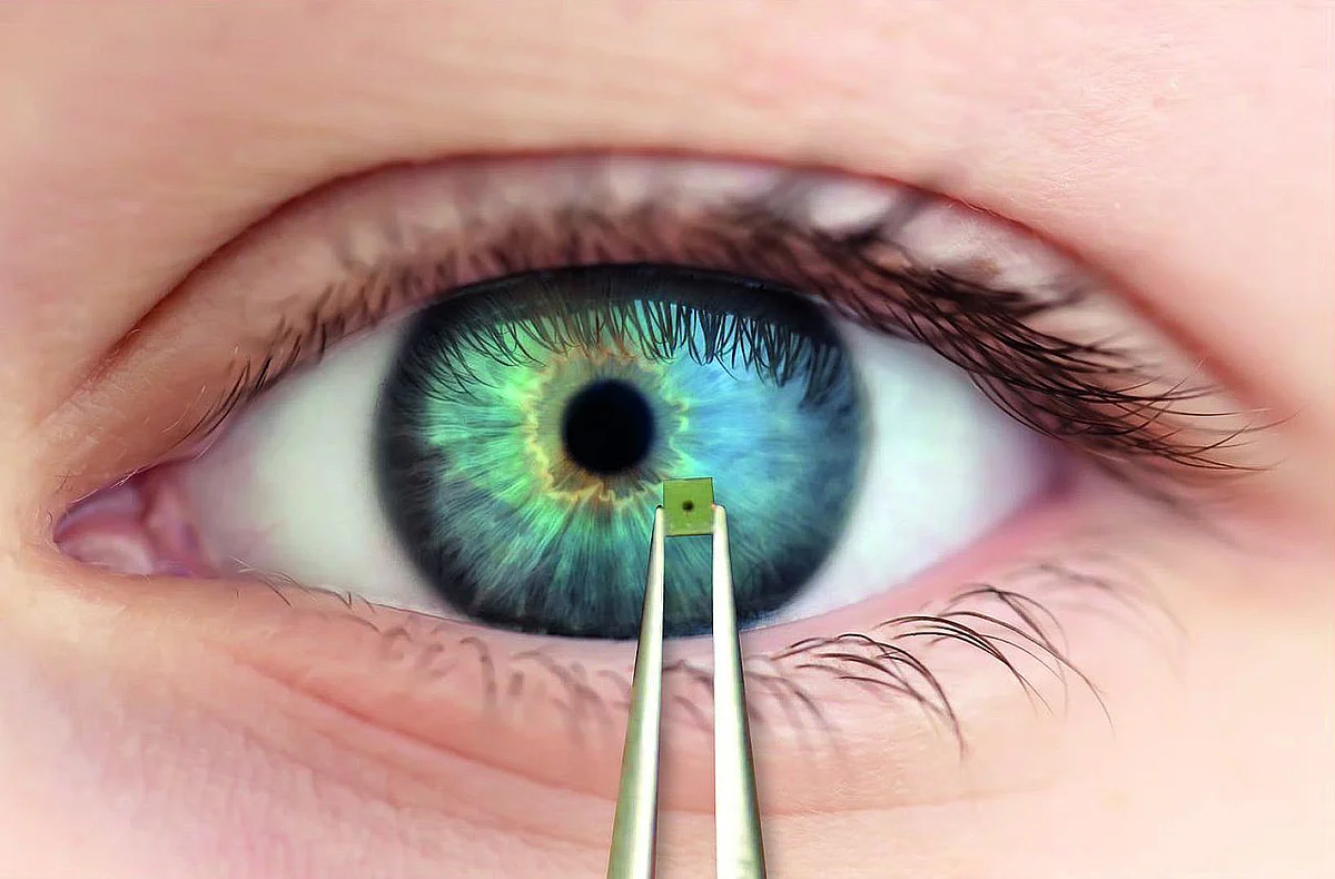 Mikrochip vor Auge 