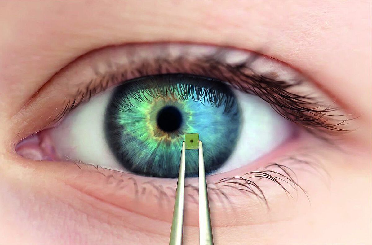 Mikrochip vor Auge 
