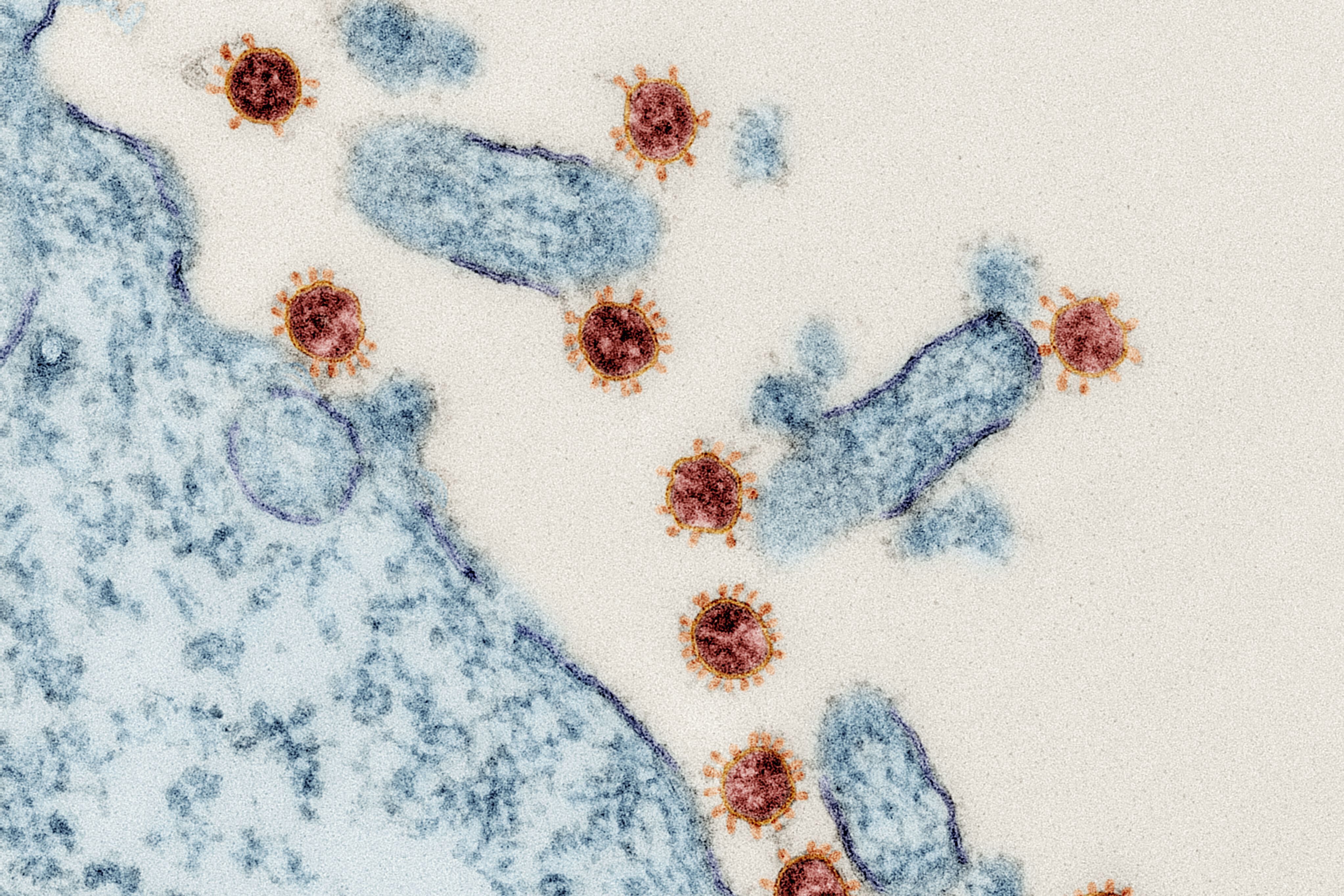 SARS-CoV-2 Viruspartikel befallen Gewebe
