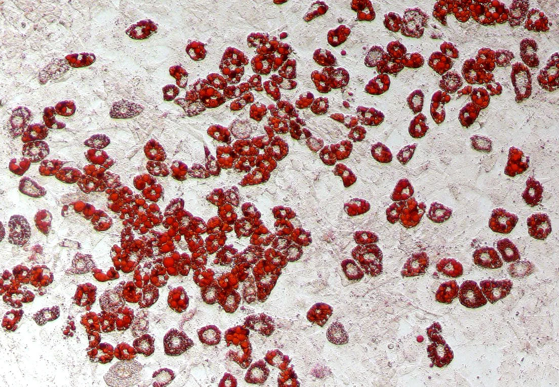 Mausfettzellen mit rot gefärbten Lipiden 