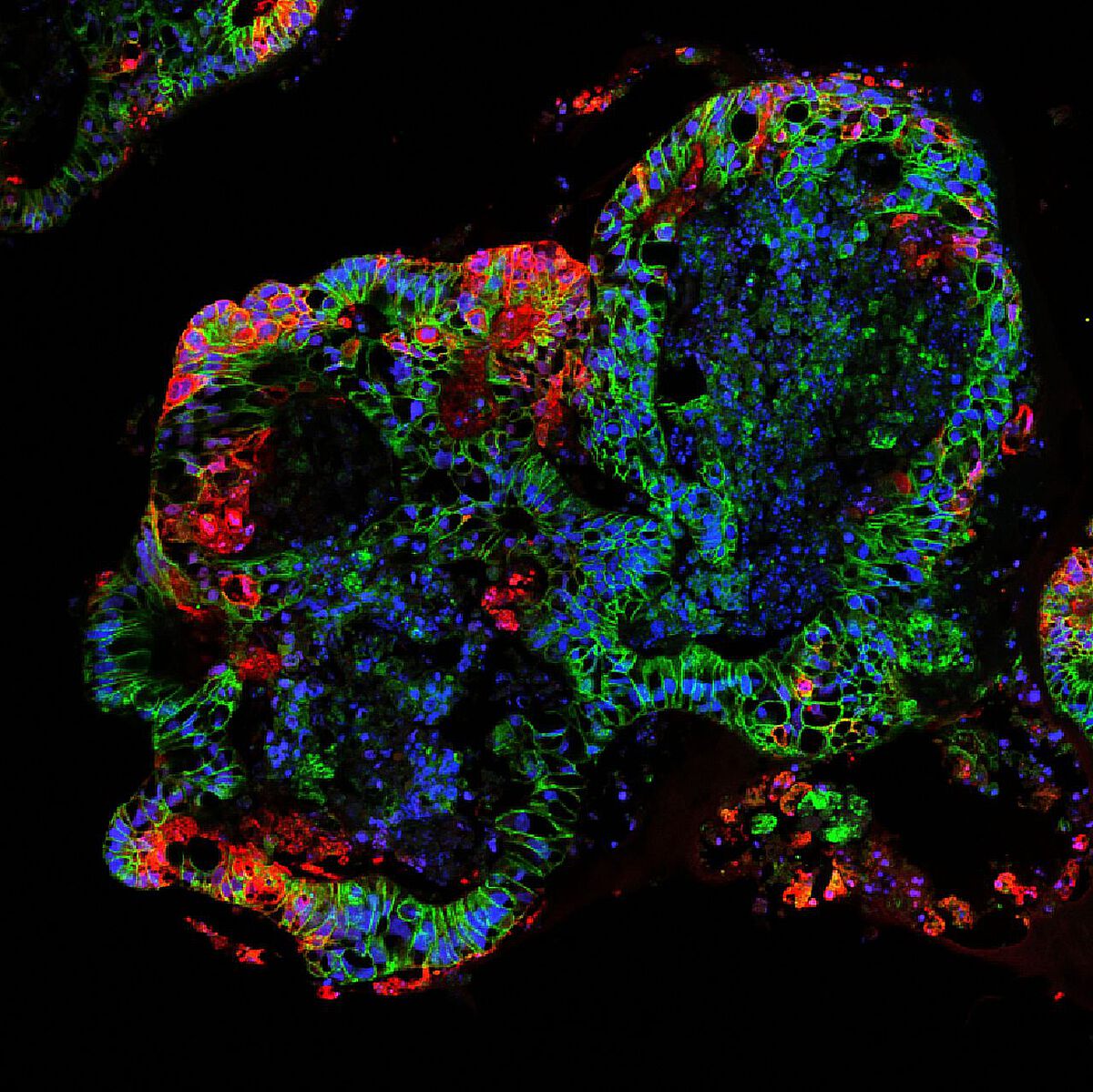 Fluoreszenzmikroskopische Aufnahme eines gefärbten Organoids
