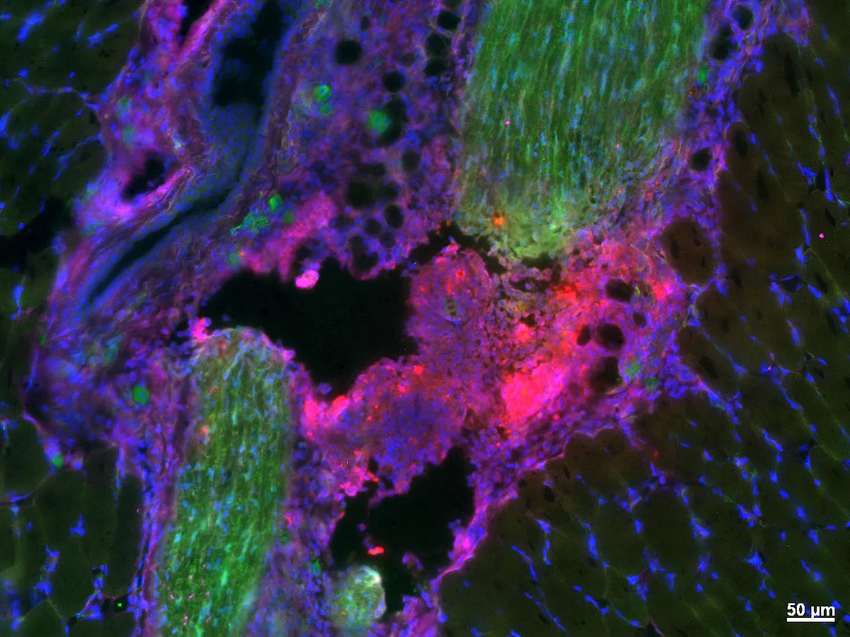 Fluoreszenzmikroskopische Aufnahme eines verletzten Gesichtsnerv
