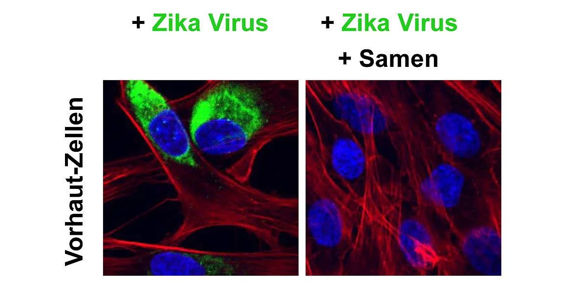 Confocal fluorescence microscopic image of foreskin fibroblasts (Franziska Krüger) 