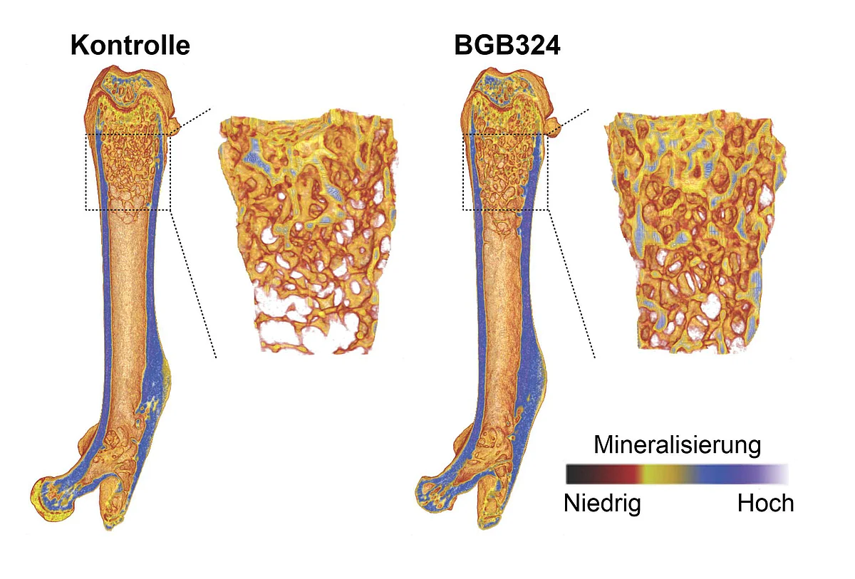 Micro-computed tomography shows that the bone treated with the active substance BGB324 has a higher density 
