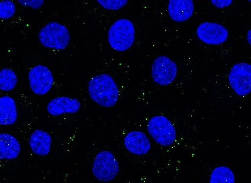 Confocal fluorescence microscopic image (Franziska Krüger)