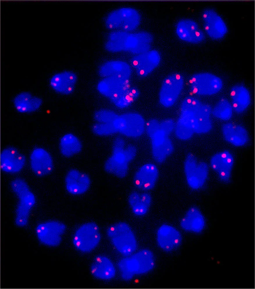 Telomere bilden die Endstücke der Chromosomen
