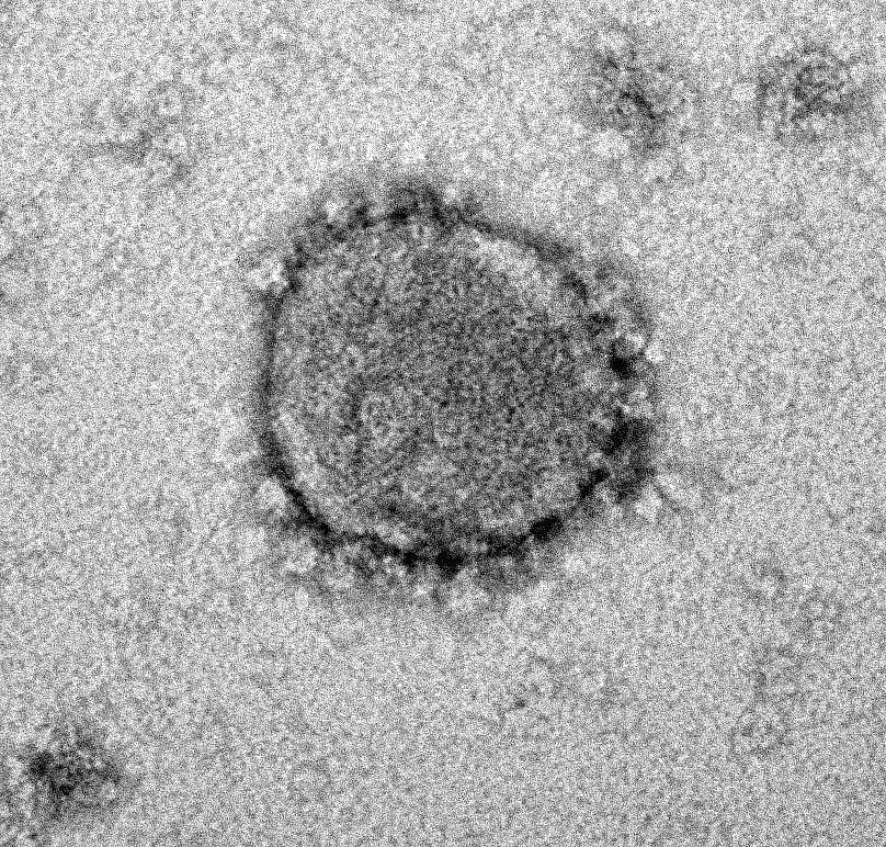 Elektronenmikroskopische Aufnahme eines Coronavirus SARS-CoV-2