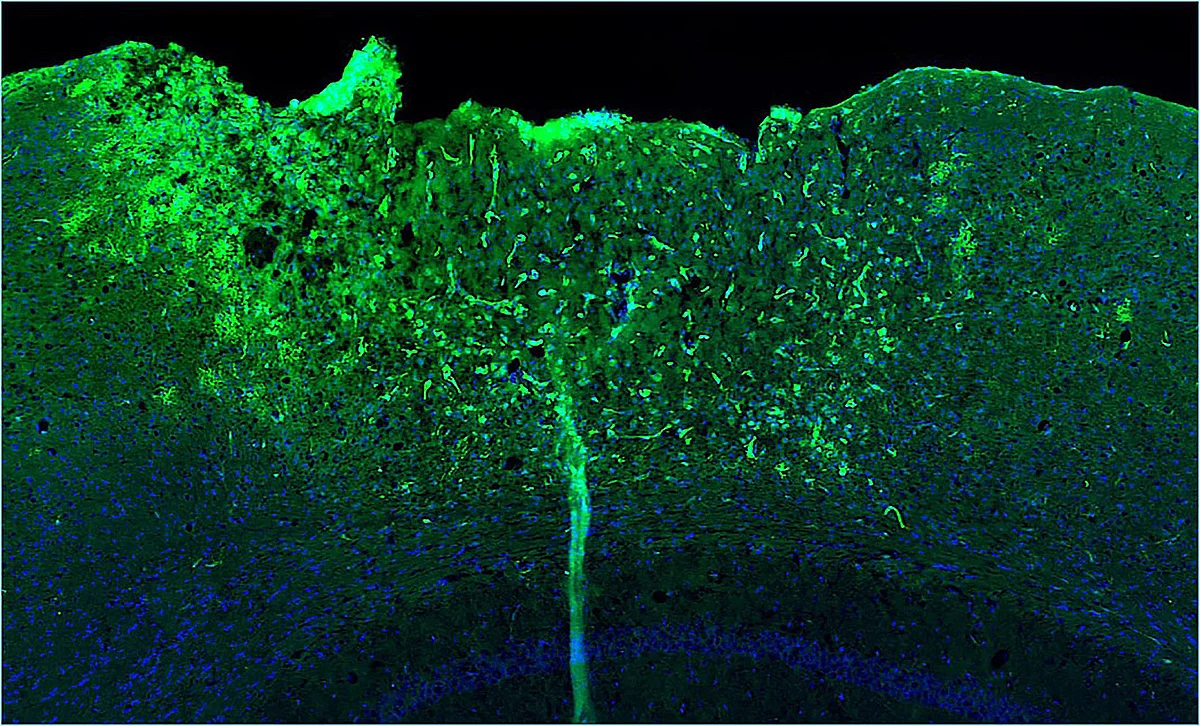 Fluorescence microscope image NF-κB Activity 