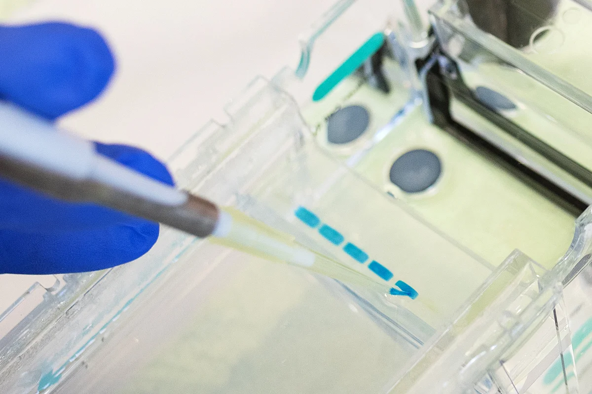 Eine Probe wird für die Gelelektrophorese vorbereitet.