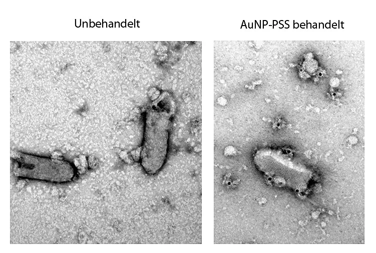 EM-Aufnahmen von VSV-Pseuoviren 