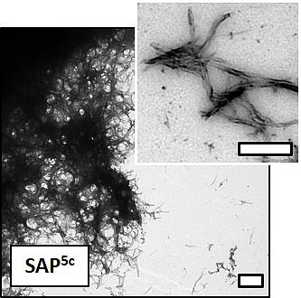 Elektronenmikroskopische Aufnahme eines Nanofibrillengeflechts