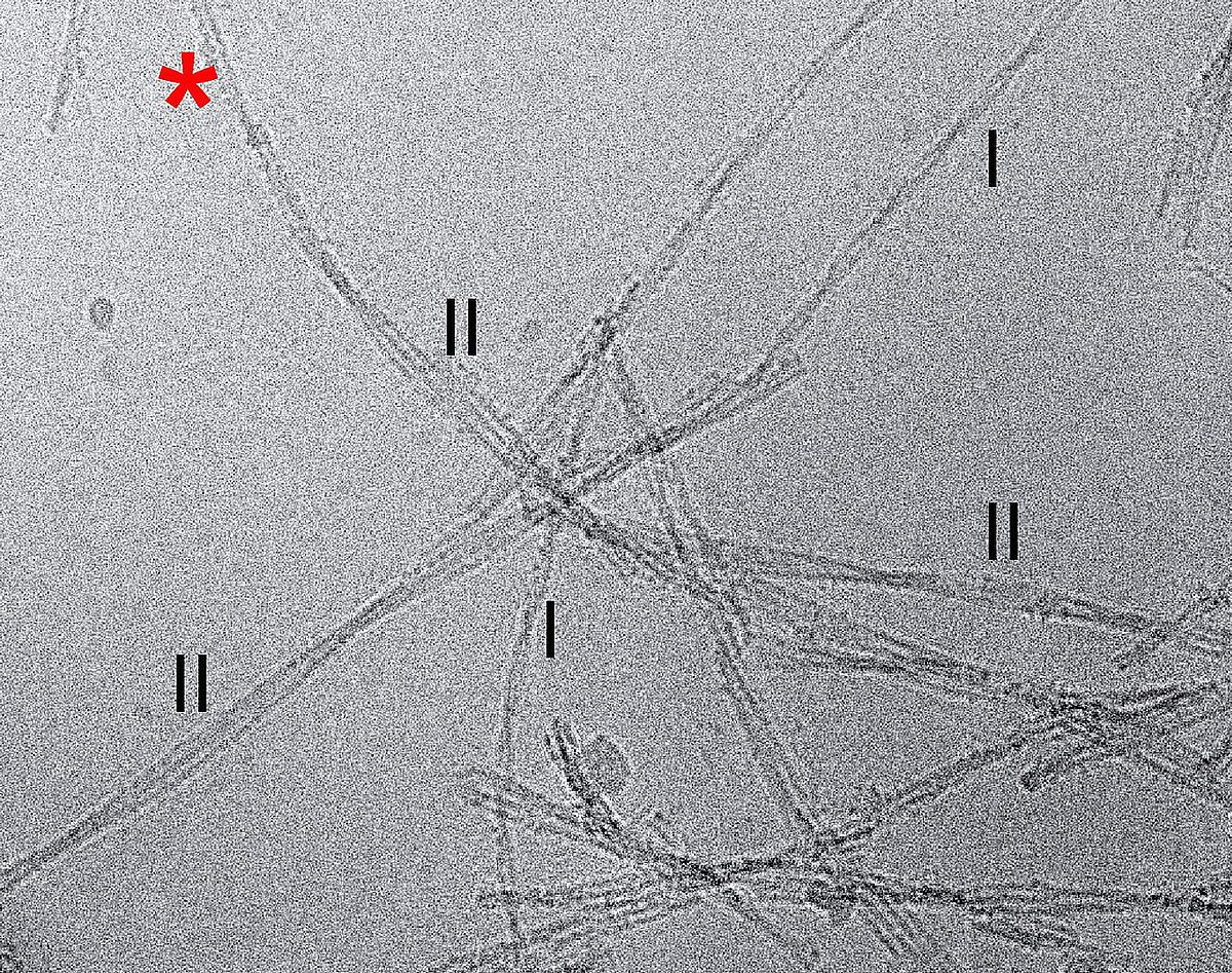 Cryo-electron microscopic images of Aß amyloid fibrils