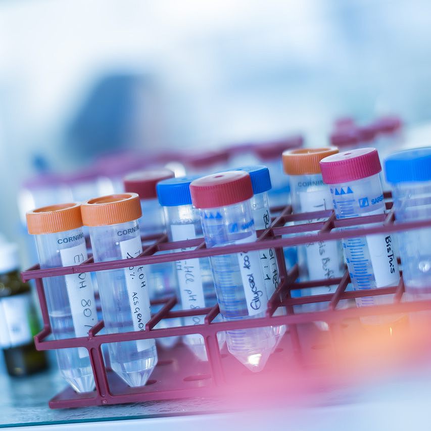 Several labelled test tubes in a laboratory rack.