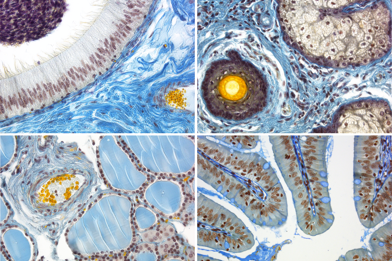 Ulmer HOPA-Färbung 4 Ausschnitte histologischer Bilder