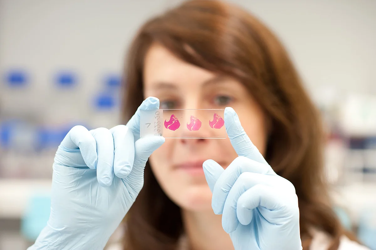 Project team member Dr. Sabine Vettorazzi analyses liver slices. As metabolic organ the liver is involved in fat metabolism. (photo: Elvira Eberhardt / Ulm University)
