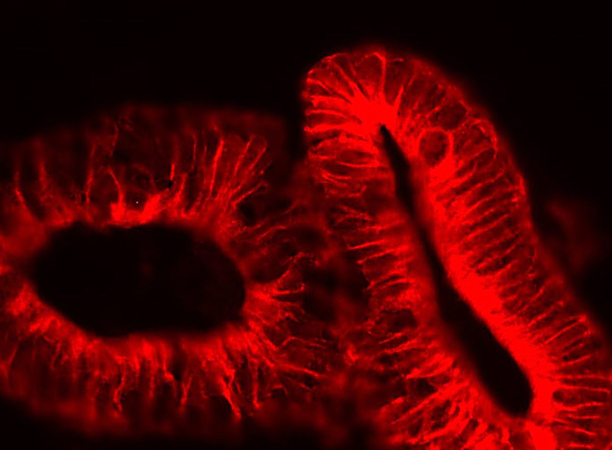 Fluoreszenzmikroskopische Aufnahme Darmorganoide 