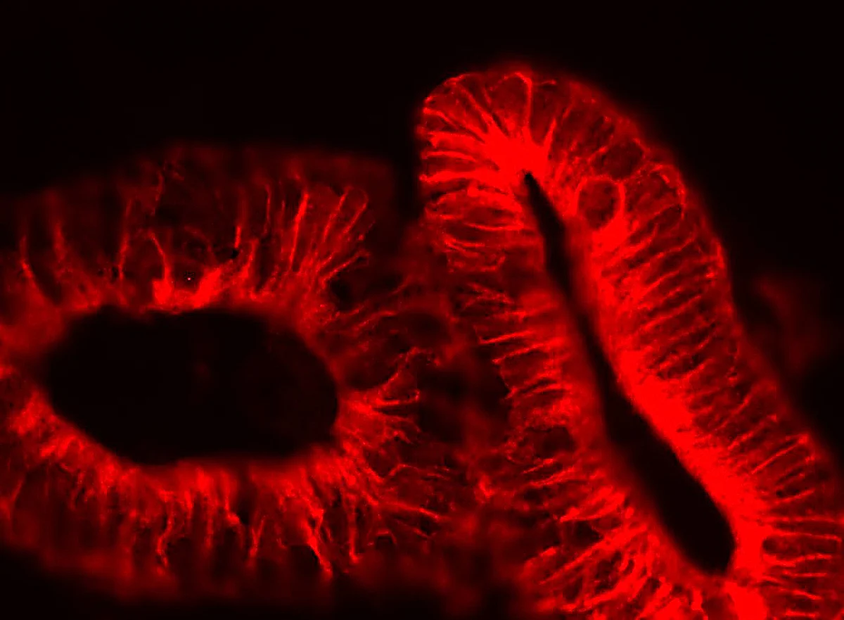 Fluoreszenzmikroskopische Aufnahme Darmorganoide 