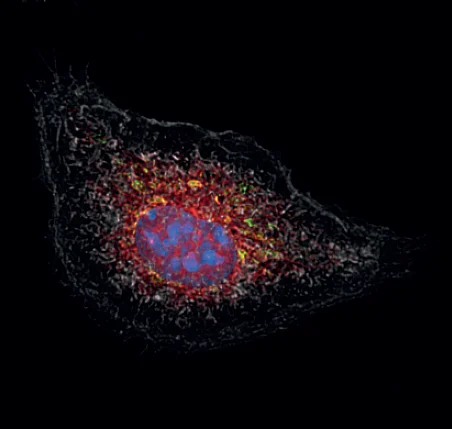 A macrophage activated by an inflammatory stimulus after being treated with cortisone.