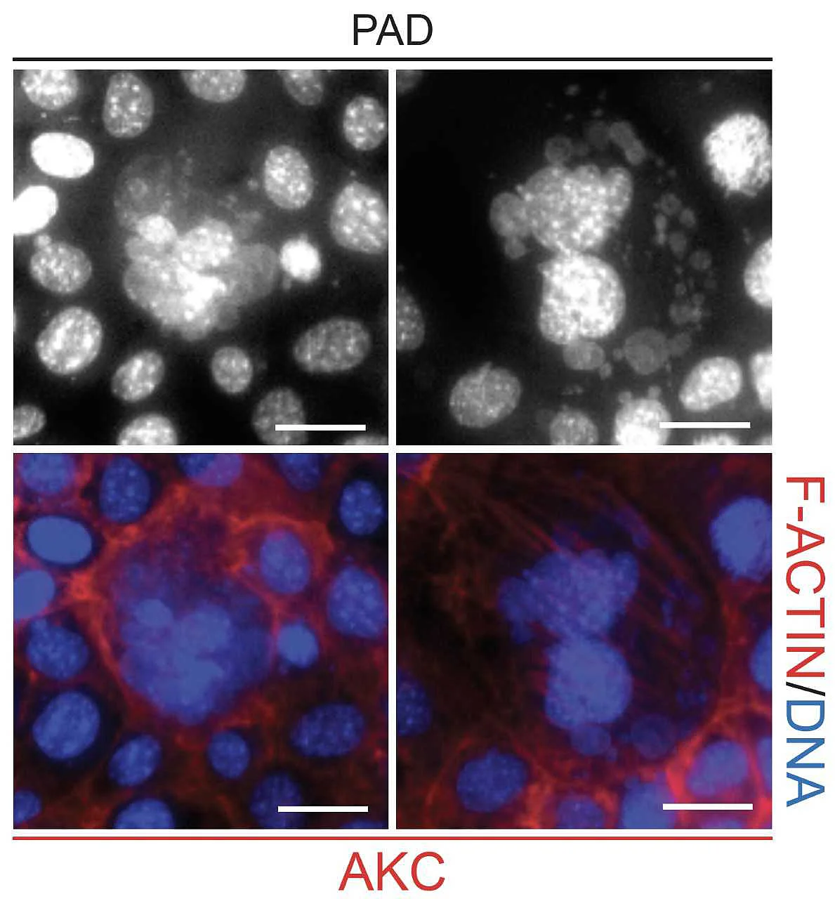 Accumulation of DNA damage