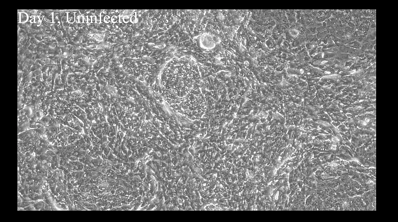 Screenshot Video spontan schlagende Herzmuskelzellen 