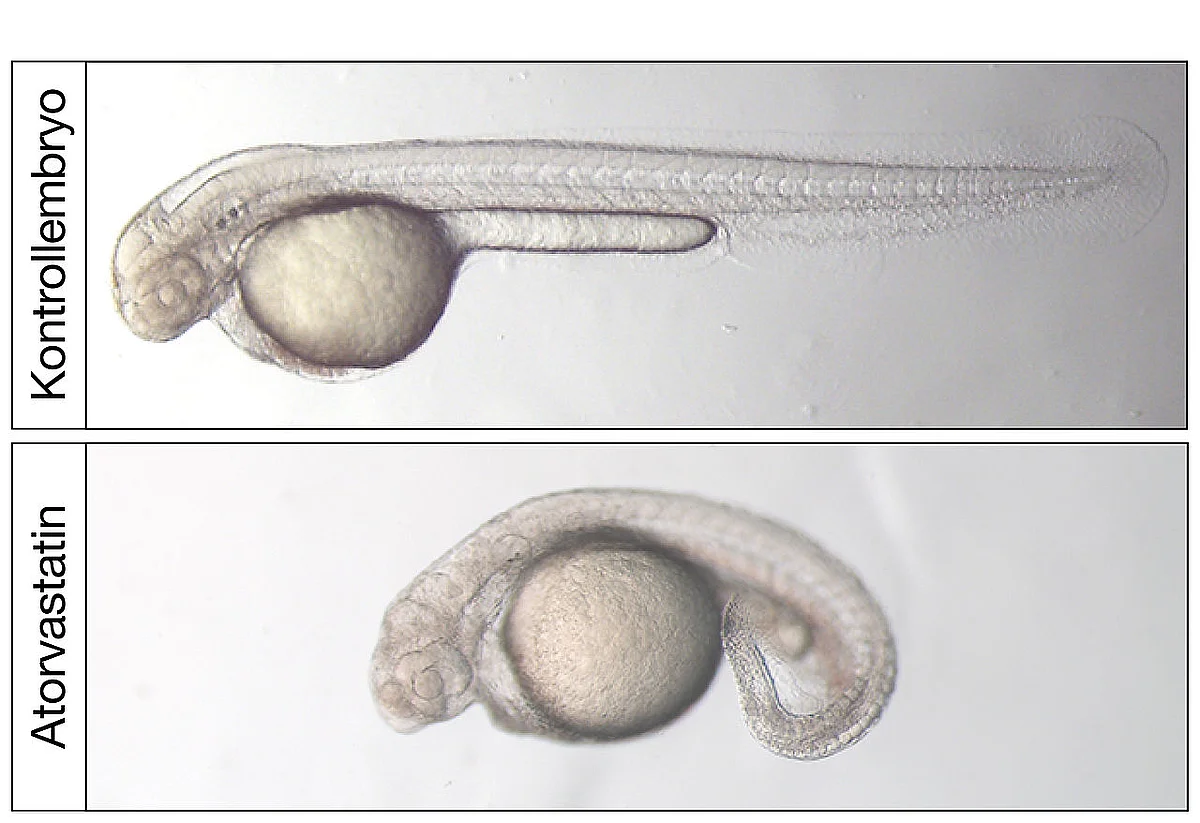 [Translate to english:] Lichtmikroskopische Aufnahme von zwei Tage alten Zebrafischembryonen. Behandlung mit dem Cholesterinsenker Atorvastatin führt zu stark deformierten Zebrafischembryonen