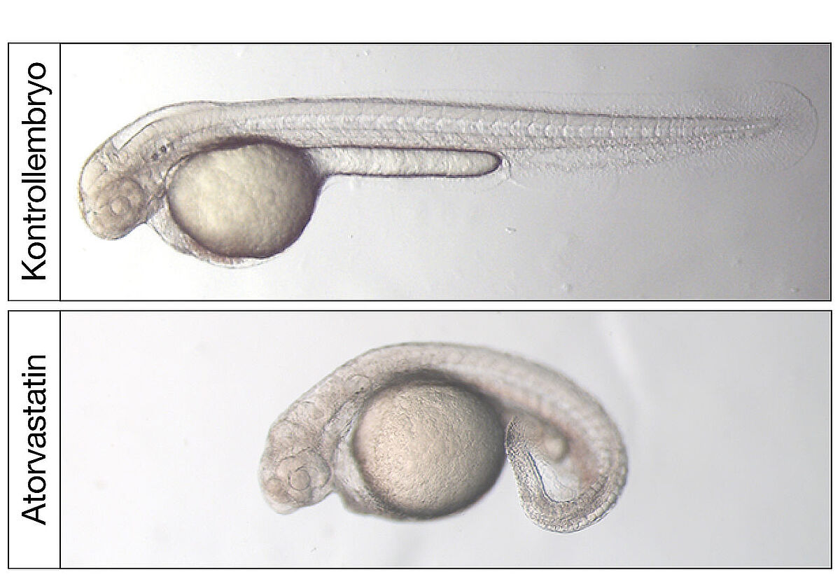 Lichtmikroskopische Aufnahme von zwei Tage alten Zebrafischembryonen. Eine Behandlung mit dem Cholesterinsenker Atorvastatin führt zu stark deformierten Zebrafischembryonen 