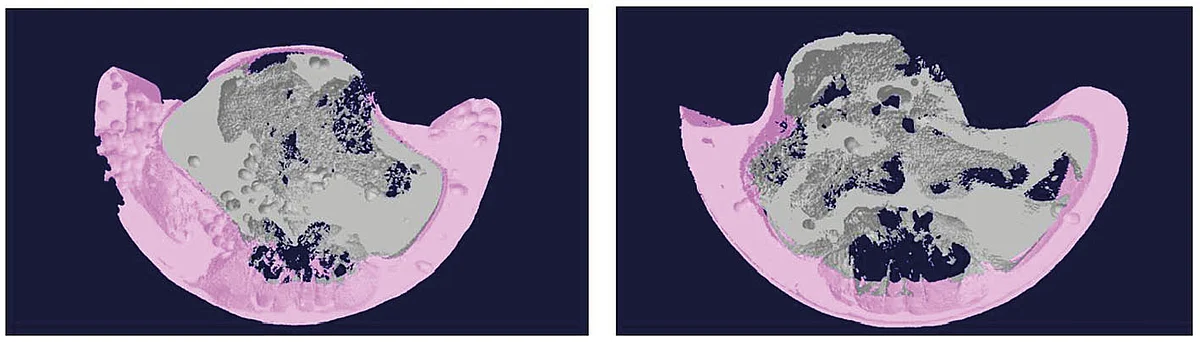 Reconstruction based on micro computer tomography imaging. The figure shows very similar effects: The mice with blocked cortisol-based stress signals have a lower percentage of subcutaneous fat (pink), which is well visible to the naked eye, but also meas
