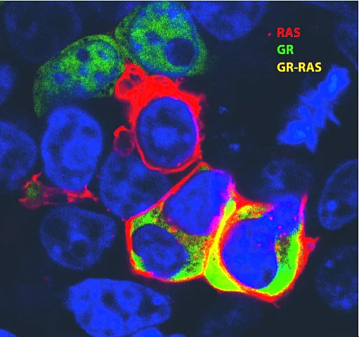 Fluoreszenzmikroskopische Aufnahme Ras