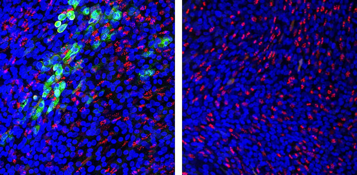 Fluoreszenzmikroskopie humaner Lungenepithelzellen nach SARS-CoV-2 Infektion 